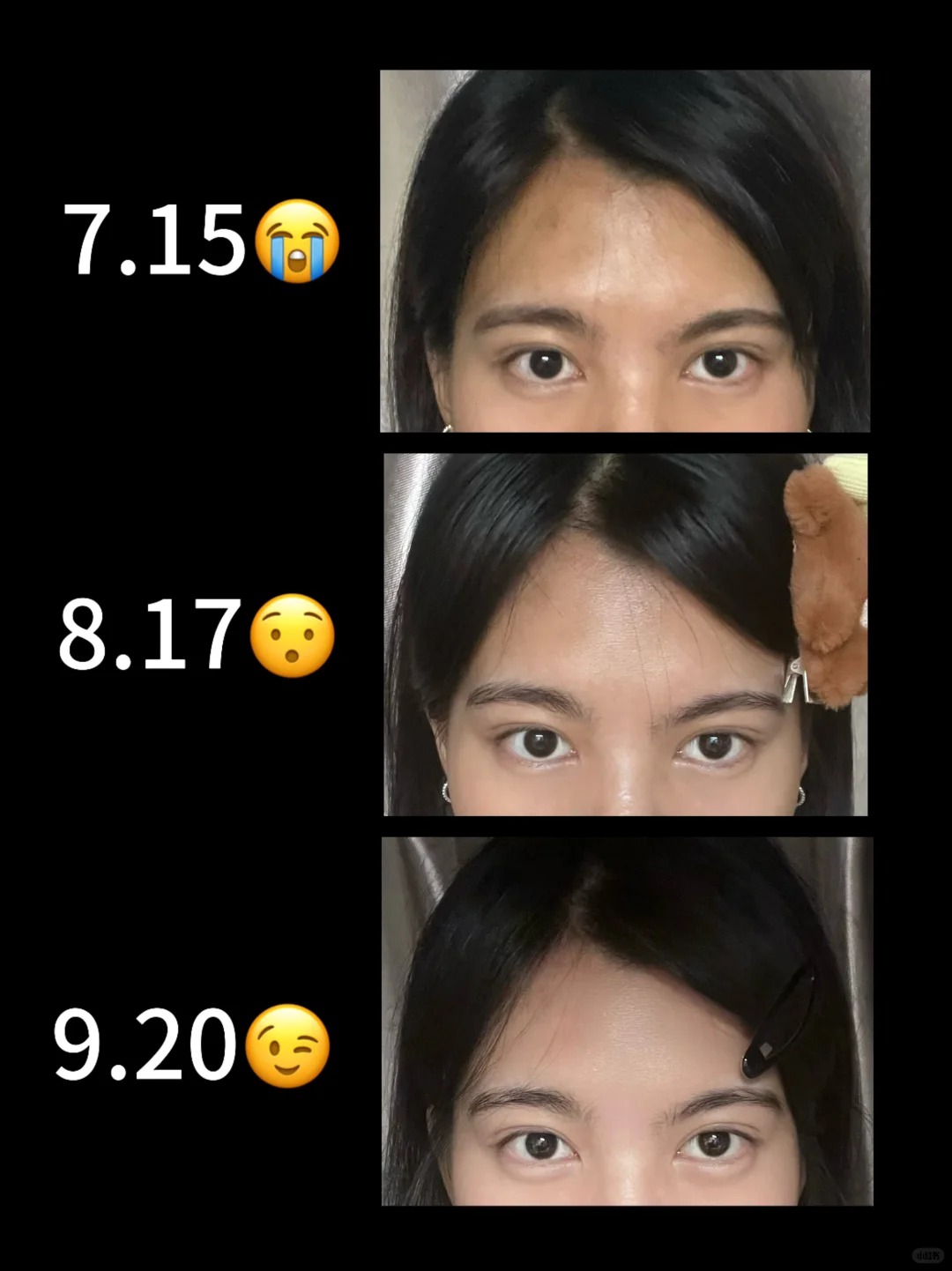 2026年美白爽肤水TOP5性价比大揭秘，你的选择对了吗？