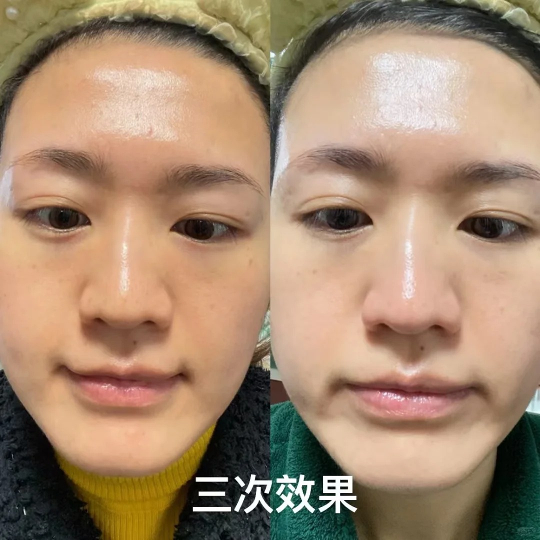 2026年美白爽肤水TOP10排行榜，你用对了吗？