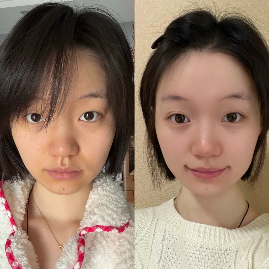 2026年美白爽肤水TOP5排行榜，哪款真正有效？